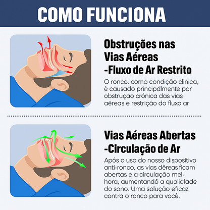 SleepGuard Pro — Antirronquido Ajustable para Noches Silenciosas y Sueño Reparador